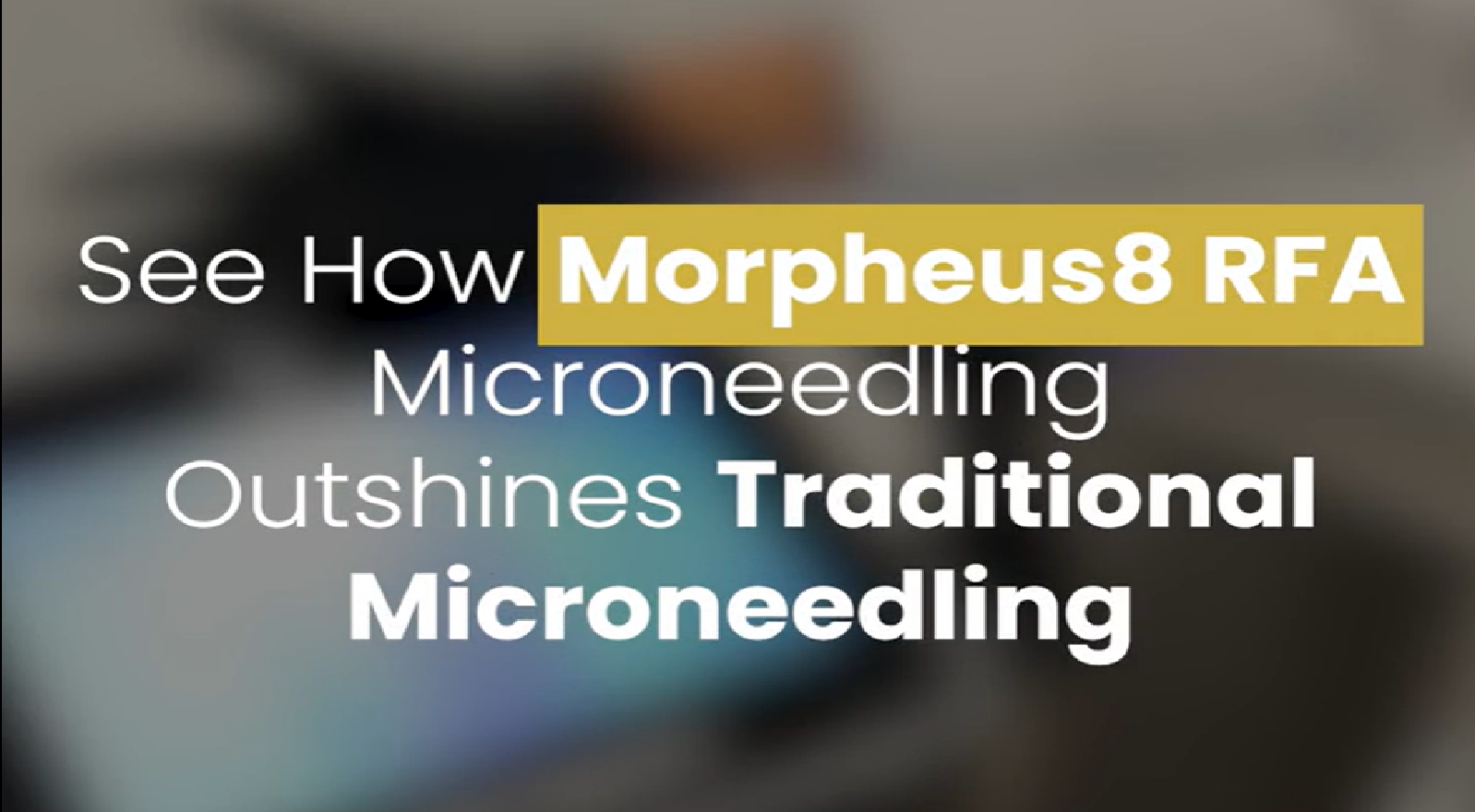 Morpheus8 RFA Microneedling